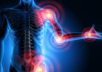 The Role of DSE in Musculoskeletal Disorders