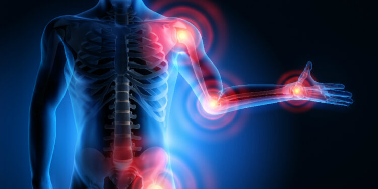 The Role of DSE in Musculoskeletal Disorders