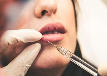 Everything You Need to Know About Buying Dermal Fillers Online
