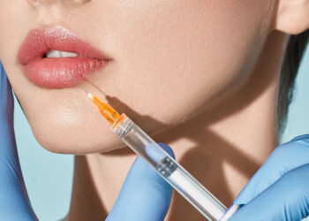 Restylane Kysse: A Revolutionary Lip Filler