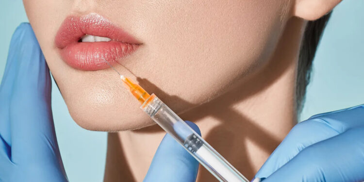 Restylane Kysse: A Revolutionary Lip Filler