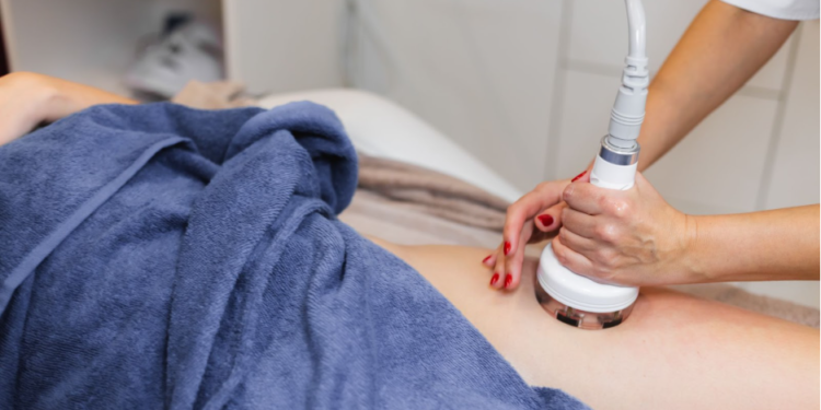 Avéli Cellulite Treatment in Philadelphia, PA: A Revolutionary Solution for Smooth Skin