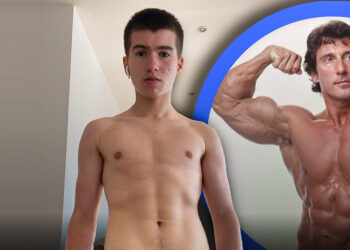 Narrow Clavicles: Causes, Symptoms, and What They Mean for You