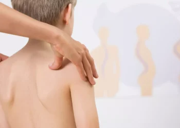 Exploring Expert Scoliosis Care with a Renowned Phoenix Specialist
