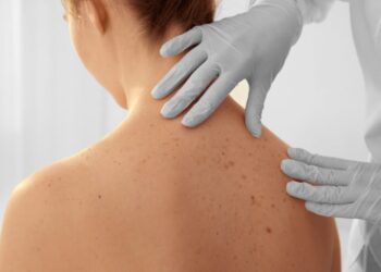 Skin Check Morningside for Early Detection