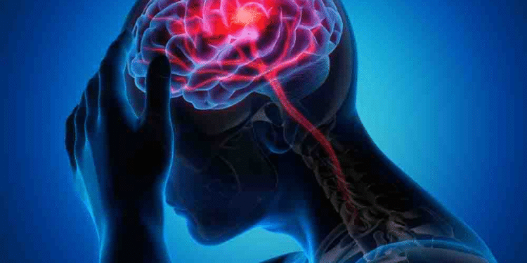 Is There a Link Between Leaky Gut and Migraines? Understanding the Connection