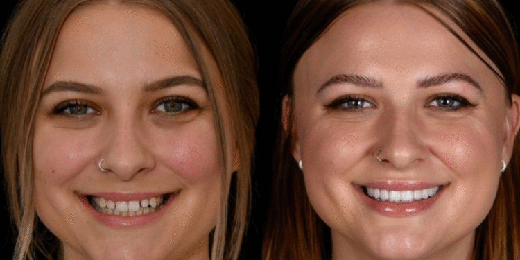 How Your Teeth Shape Your Face (More Than You Think)