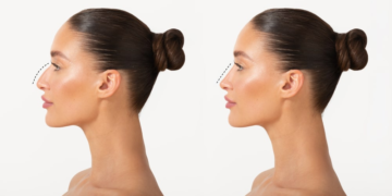 Best Glasses for a High Nose Bridge: Fit Tips That Actually Work